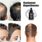 RU58841 10% - STOP Hair Loss - DHT Blocker - Highest Percentage Available on the Planet - One Month Supply