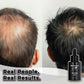 RU58841 10% - STOP Hair Loss - DHT Blocker - Highest Percentage Available on the Planet - One Month Supply