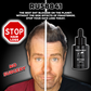 RU58841 10% - STOP Hair Loss - DHT Blocker - Highest Percentage Available on the Planet - One Month Supply
